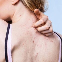 Lasers Medical Spa