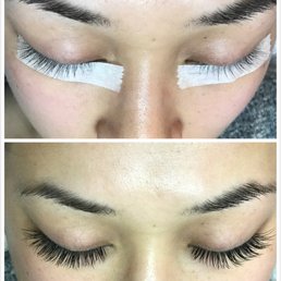 Before and after
