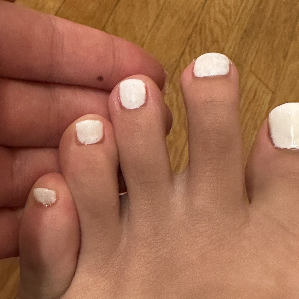 Nail 27 - Poor quality gel toenails - Nail Salons Near Me - Kendall Park, New Jersey Nail 27 - Poor quality gel toenails - Nail Salons Near Me - Kendall Park, New Jersey