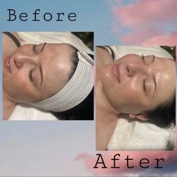 Monterey Day Spa - Before and After 90 Minute Facial