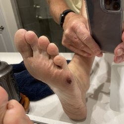 US Nails - This is a pic of my foot a few days later.