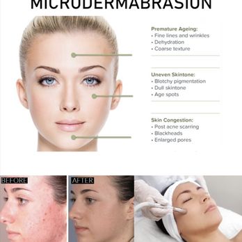 Jill's iBrow Threading salon - Microdermabrasion! - Threading Services Near Me - Fayetteville, North Carolina Jill's iBrow Threading salon - Microdermabrasion! - Threading Services Near Me - Fayetteville, North Carolina