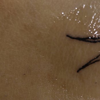 Classic 13 Tattoo - Suppose to be a straight line. Obviously not a straight line. Very angry and on my body for the rest of my life. - Tattoo Near Me - Birmingham, Alabama Classic 13 Tattoo - Suppose to be a straight line. Obviously not a straight line. Very angry and on my body for the rest of my life. - Tattoo Near Me - Birmingham, Alabama