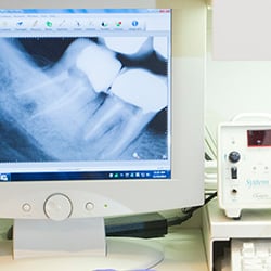 Danielle Jaffe, DDS - Broward Endodontics - Digital Radiography