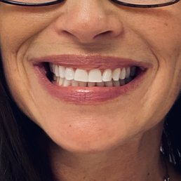 Happy clean teeth Happy clean teeth