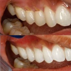 WCI Dental Group