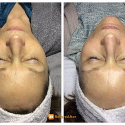 HD Skincare Solutions
