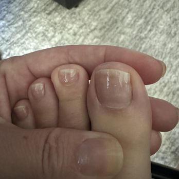 Lavish Nail Lounge - The white is not the end of my nails.  That's the damage from the grinder!!!  I buffed the ridges away but still seen w/ polish - Nail Salons Near Me - Las Vegas, Nevada