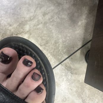 Nail Pavilion - This is one of my toes two days after I got a gel polish. That they wouldn't fix. - Nail Salons Near Me - Mission Hills, California Nail Pavilion - This is one of my toes two days after I got a gel polish. That they wouldn't fix. - Nail Salons Near Me - Mission Hills, California