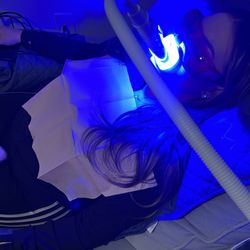 E Beauty - LED light activated professional teeth whitening.