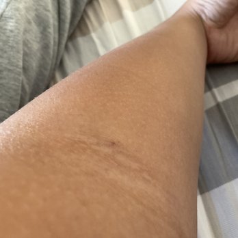 Sun Clinical Labs - My hand is already drawed and it's kinda ok thought - Laboratory Testing Near Me - Monterey Park, California Sun Clinical Labs - My hand is already drawed and it's kinda ok thought - Laboratory Testing Near Me - Monterey Park, California
