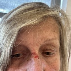 Advocare Haddonfield Pediatric Association - Hit my head on the way down the steps, 14 steps