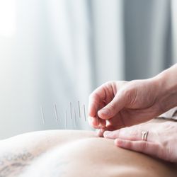 Yarmouth Acupuncture