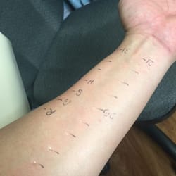 Kam Jeffrey MD - They inject a small samples by way of a small dab (feels like a toothpick prick).  20 minutes later ; a list of your allergies.