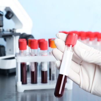 Coastline Mobile Phlebotomy - Laboratory Testing Near Me Coastline Mobile Phlebotomy - Laboratory Testing Near Me
