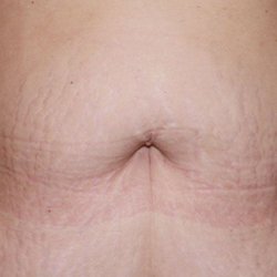 Zieg Plastic Surgery Center
