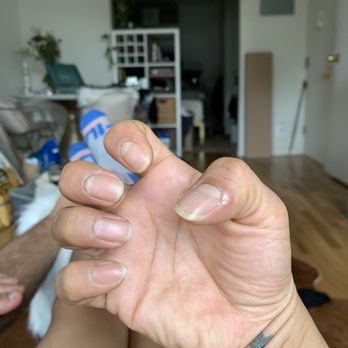 Honey Nail Salon - Not well done manicure & Cut my Tumb - Nail Salons Near Me - Brooklyn, New York Honey Nail Salon - Not well done manicure & Cut my Tumb - Nail Salons Near Me - Brooklyn, New York