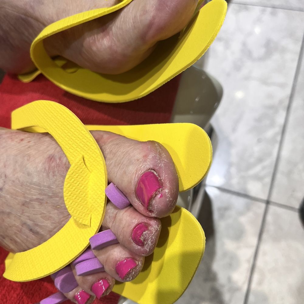 Worse pedicure ever..zoom in.