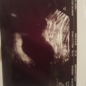 Baby Bump Studios - Ultrasound Imaging Centers Near Me - Moreno Valley, California Baby Bump Studios - Ultrasound Imaging Centers Near Me - Moreno Valley, California