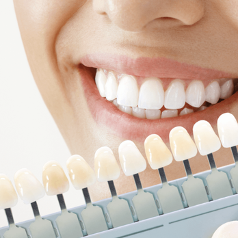Pryor Dental - Cosmetic Dentists Near Me - Winston-Salem, North Carolina Pryor Dental - Cosmetic Dentists Near Me - Winston-Salem, North Carolina