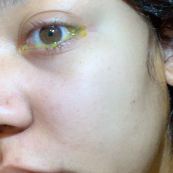 Tip Top Nails - This was my eye right before I went to the ER - Nail Salons Near Me - Gallup, New Mexico Tip Top Nails - This was my eye right before I went to the ER - Nail Salons Near Me - Gallup, New Mexico