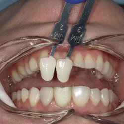 Advanced Dental Designs