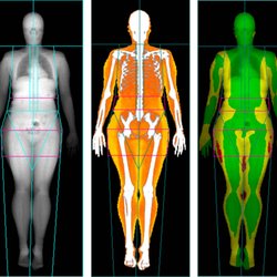 Live Lean Rx Houston - DEXA Imaging