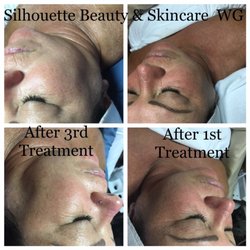 Silhouette Beauty & Skincare