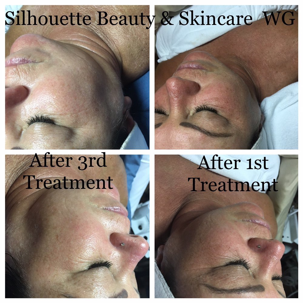 Silhouette Beauty & Skincare Logo