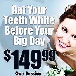 Rapid Smile Labs Teeth Whitening Southlake