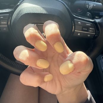 Aspen Nail Salon - My uncured SNS with specks of red glitter in it because of how dirty the salon was. - Nail Salons Near Me - Flagstaff, Arizona Aspen Nail Salon - My uncured SNS with specks of red glitter in it because of how dirty the salon was. - Nail Salons Near Me - Flagstaff, Arizona