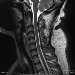 Oregon Advanced Imaging - Neck MRI