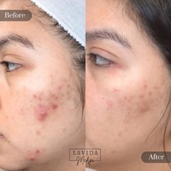 LaVida Medspa