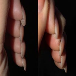 1 Nails - Before (left) and after fixing but before polish (right)