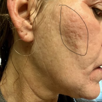 Skin MD - Dermatologists Near Me - Orland Park, Illinois Skin MD - Dermatologists Near Me - Orland Park, Illinois