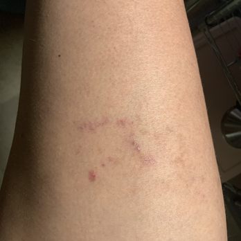 Venus Fashion - Jeans caused burns on leg. Company said get a lawyer. - Women's Clothing Near Me - Jacksonville, Florida Venus Fashion - Jeans caused burns on leg. Company said get a lawyer. - Women's Clothing Near Me - Jacksonville, Florida