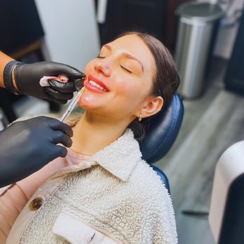 NIMS Medspa - Lip filler with a smile! - Skin Care Near Me - Houston, Texas NIMS Medspa - Lip filler with a smile! - Skin Care Near Me - Houston, Texas