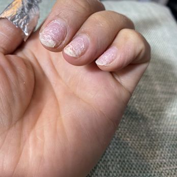 Blin Nails & Spa - Those white lines are layers of my own nails. Plastic forced so hard & far in it ripped and cut through my nail. Disappointed - Nail Salons Near Me - Covina, California Blin Nails & Spa - Those white lines are layers of my own nails. Plastic forced so hard & far in it ripped and cut through my nail. Disappointed - Nail Salons Near Me - Covina, California
