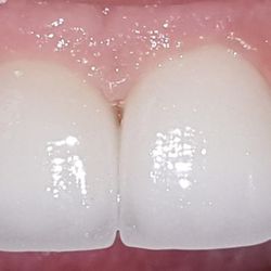 Gary Osmanoff, DDS