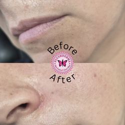 Plush Derma