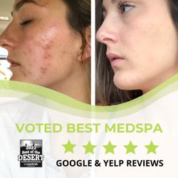 Uptown Medispa - Clinical Facial Results
