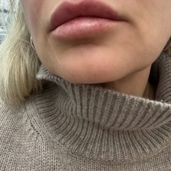 Skin Envy Cosmetic and Laser Center - Please I'm in love!
