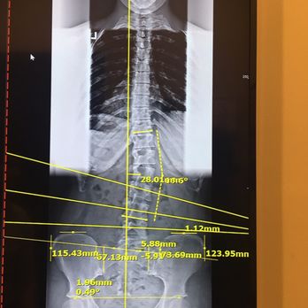 Intero Chiropractic - My first x ray in July - Chiropractors Near Me - Pleasanton, California Intero Chiropractic - My first x ray in July - Chiropractors Near Me - Pleasanton, California