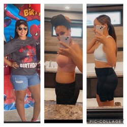 Tailored Weight Loss II - Patient down 30lbs!
