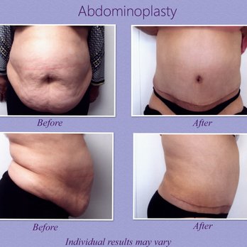 Nouri Ghorbani, MD - Cosmetic Surgeons Near Me - Walnut Creek, California Nouri Ghorbani, MD - Cosmetic Surgeons Near Me - Walnut Creek, California