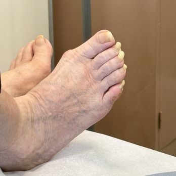 Henry Tseng, DPM - Those are long toe nails - Podiatrists Near Me - West Covina, California Henry Tseng, DPM - Those are long toe nails - Podiatrists Near Me - West Covina, California