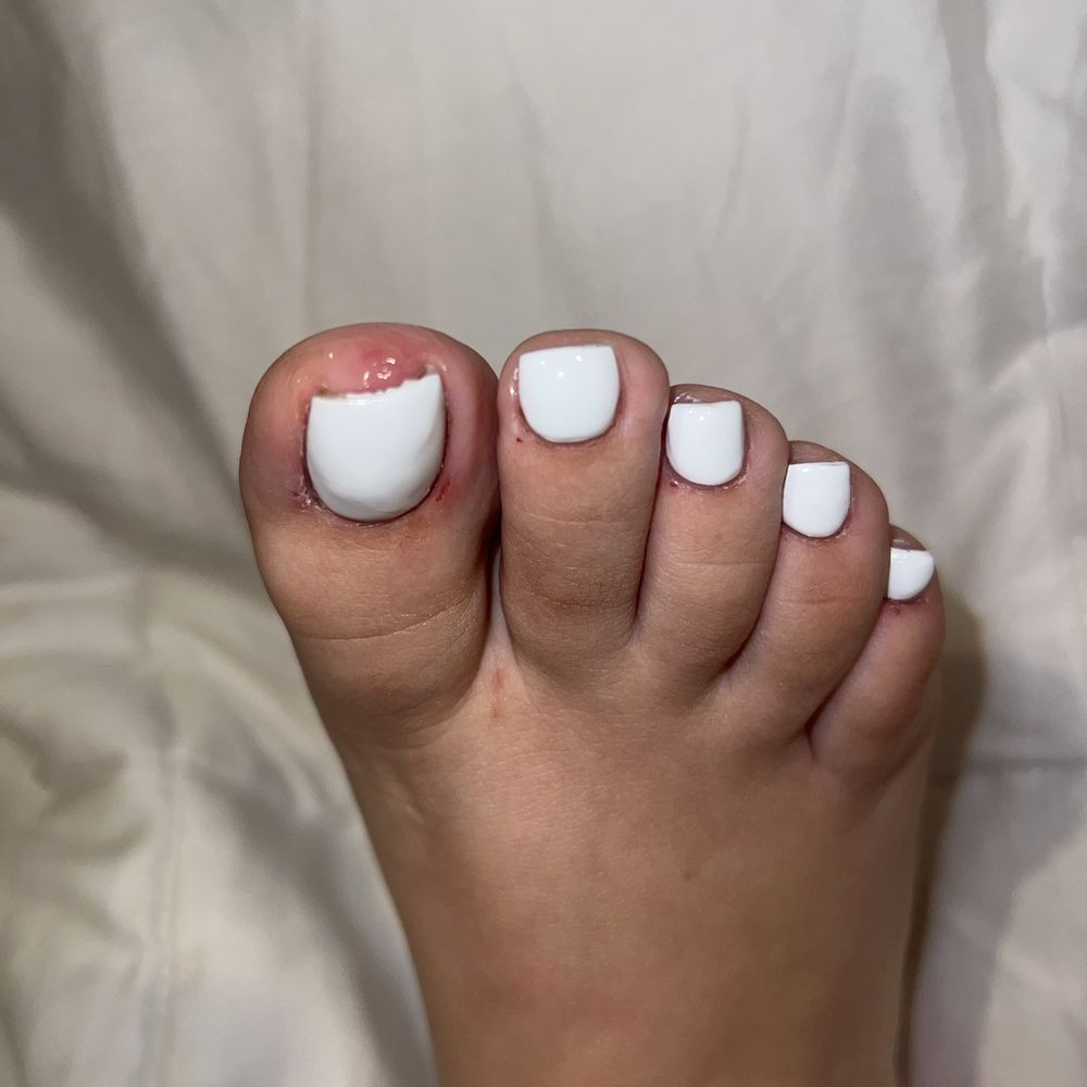 Annie Nails & Spa - here are the cuts she left me after expressing she was hurting me. i should have just got up and left immediately. - Nail Salons Near Me - Whittier, California Annie Nails & Spa - here are the cuts she left me after expressing she was hurting me. i should have just got up and left immediately. - Nail Salons Near Me - Whittier, California
