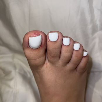 Annie Nails & Spa - here are the cuts she left me after expressing she was hurting me. i should have just got up and left immediately. - Nail Salons Near Me - Whittier, California