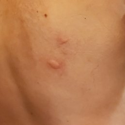 More bites