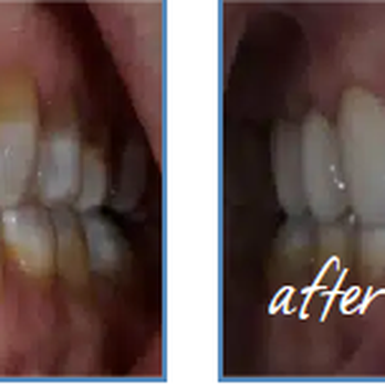Merrell & Nichols Dentistry - Cosmetic Dentists Near Me - Lubbock, Texas Merrell & Nichols Dentistry - Cosmetic Dentists Near Me - Lubbock, Texas